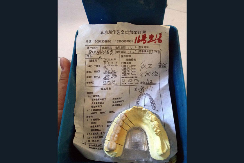 11月14日,北京通州区宋庄镇小堡西街133号,精佳艺义齿加工中心,制作好
