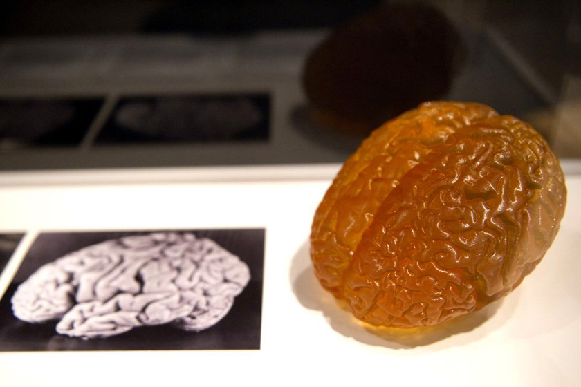 爱因斯坦的大脑照片和模型。 MIGUEL MEDINA/东方IC_英国“人脑展”展出爱因斯坦大脑切片