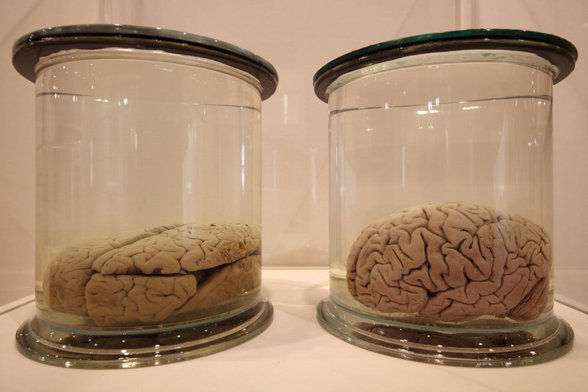 展出的大脑标本。 Dan Kitwood/Getty Images/CFP_英国“人脑展”展出爱因斯坦大脑切片