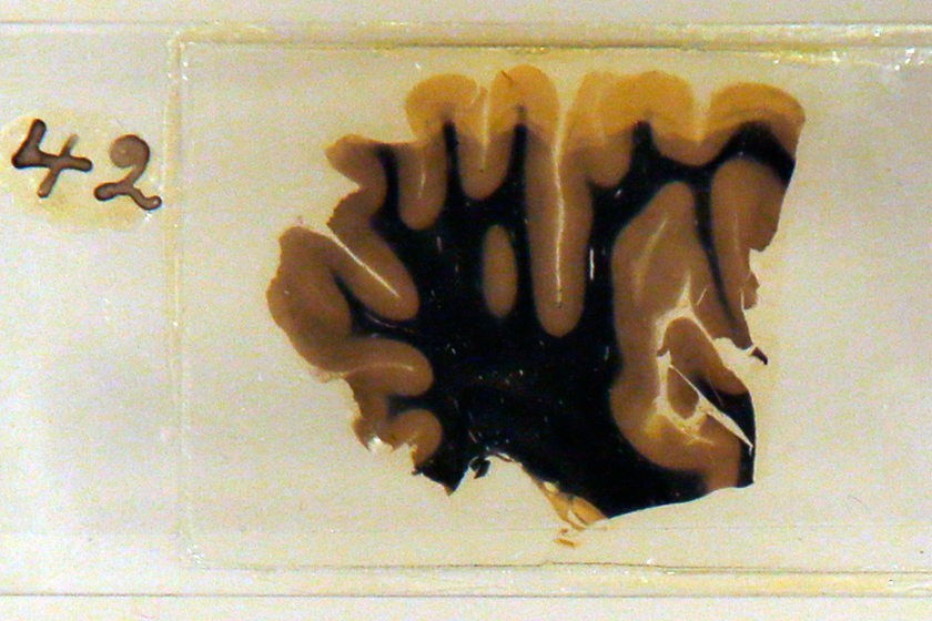 爱因斯坦大脑切片，保存在甲醛溶液中。 Chris Helgren/REUTERS_英国“人脑展”展出爱因斯坦大脑切片