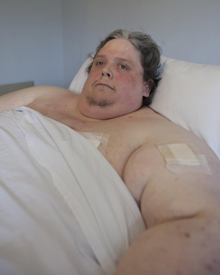 2月17日，伦敦，世界最胖男子基思·马丁。 CFP_世界最胖男子蜗居11年寸步难行