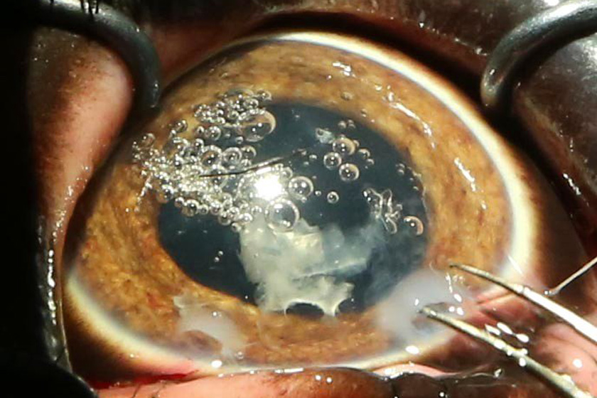 9月20日，英国德文郡佩根顿动物园的失明大象“公爵夫人”正在接受白内障手术。  Richard Austin / Rex Features/东方IC _英国大象接受世界最大白内障切除手术