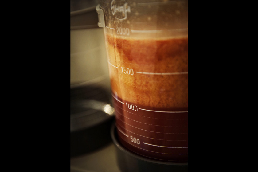 当地时间2012年6月18日，哥伦比亚波哥大，医生从Brenda身体里抽出5000毫升的脂肪、血液和水。   Moa Karlberg/东方IC _实拍哥伦比亚美容整形之旅