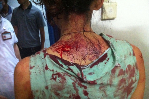 7月17日上午，湖南临武县城管局工作人员在执法过程中，与南强莲塘村村民邓正加发生争执冲突，邓正加死亡。据死者家属介绍，瓜农邓正加现年56岁，是临武县南强乡莲塘村人，拖着自家种植的西瓜来到临武县文昌路桥头叫卖时，遭到临武县城管人员暴力执法，致其当场被打死，邓正加老婆当场晕倒目前在在医院救治。