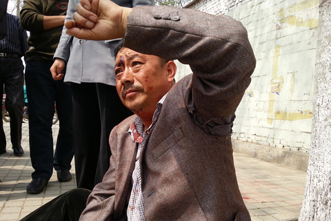 2014年4月2日，山东平度，被打伤的失地农民刘天基向公安局报案。